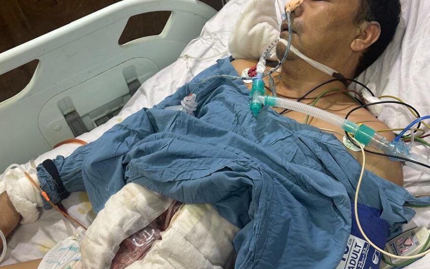 सेक्टर-52 में सनसनी : 6-7 हमलावरों ने घेरकर व्यक्ति की पीठ में घोंपा चाकू, हालत नाजुक