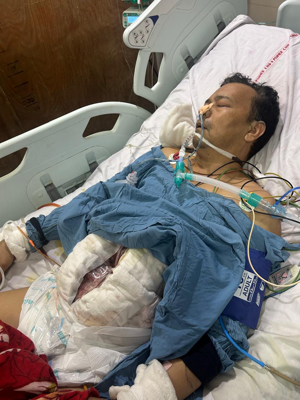 सेक्टर-52 में सनसनी : 6-7 हमलावरों ने घेरकर व्यक्ति की पीठ में घोंपा चाकू, हालत नाजुक